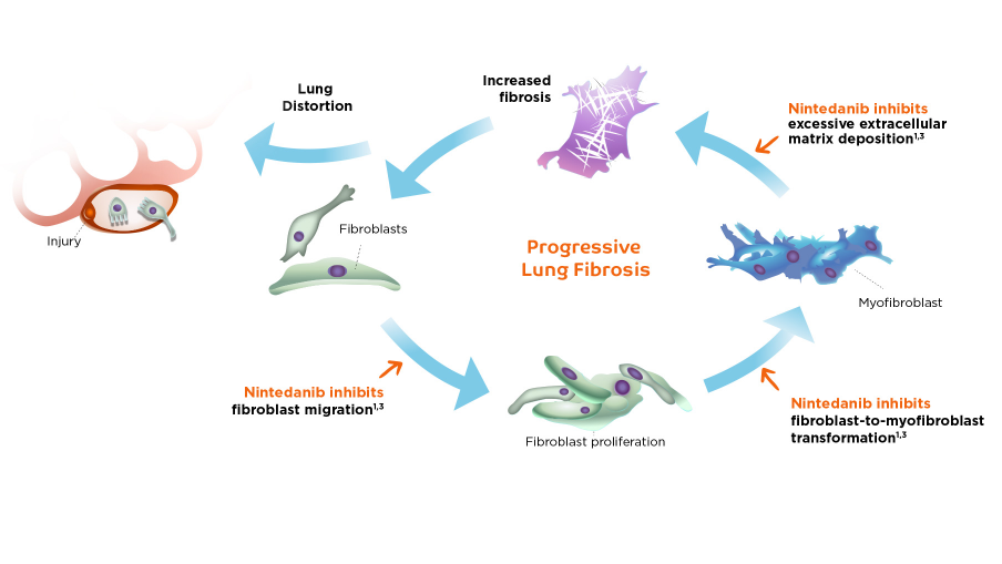 progressive-lung-fibrosis-cycle-diagram
