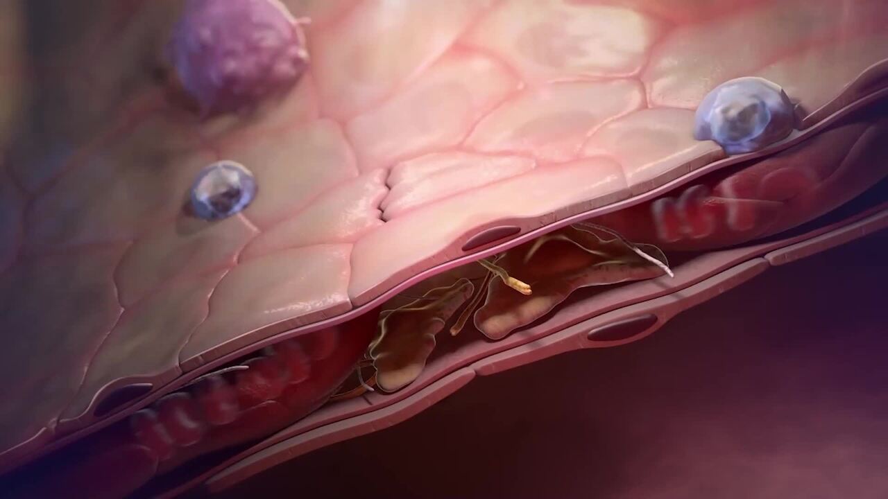 PC-SA-102502 Respiratory - Specialty OFEV